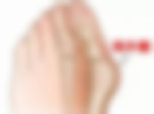 下眼袋一直抽搐别慌！选对医生特别重要