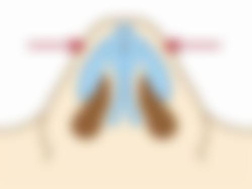 五、无锡市宜兴洵美会医疗美容门诊部怎么预约：