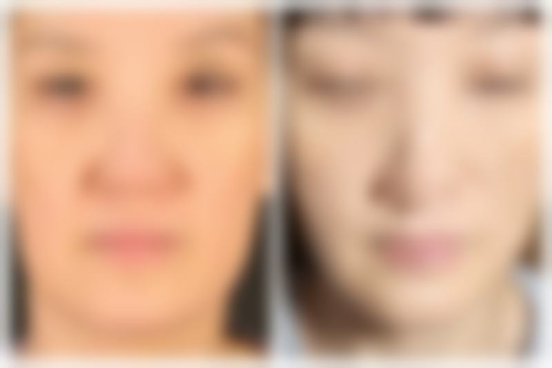 六、南通同美汇整形医疗美容门诊部价格表：（仅供参考）