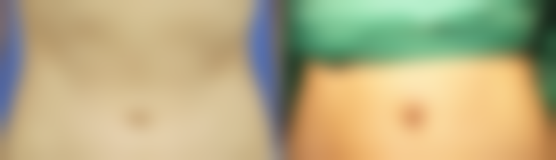 七、成都卿回嘉人医疗美容门诊真实的顾客评价如下：