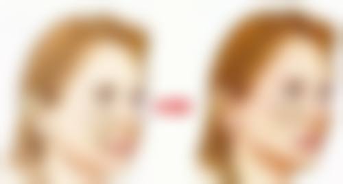 五、咸阳艾美医疗美容诊所怎么预约：