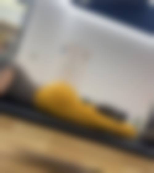 尚绍辉全身各部位脂肪抽吸水平怎么样可靠吗？