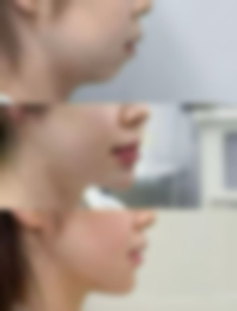 割双眼皮一月化妆，选对化妆品特别重要