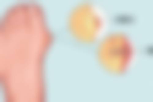 四、湖州新生植发爱美爱医疗美容诊所实例