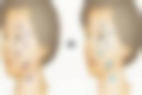 四、深圳牛翠霞整形医院实例