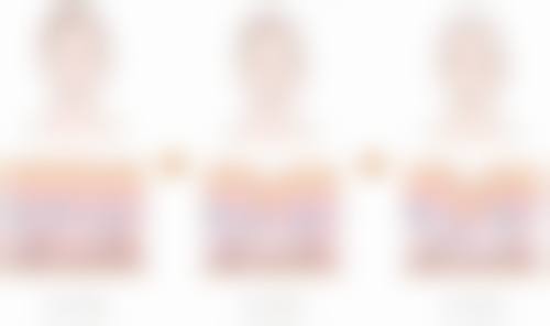 五、深圳牛翠霞整形医院怎么预约：