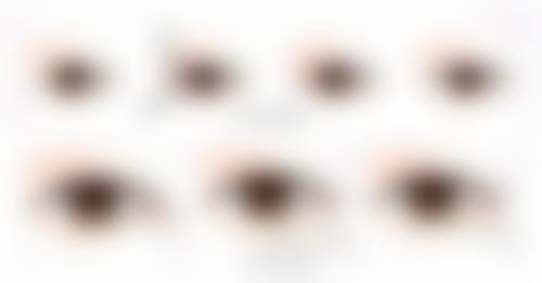 规范操作与护理，收获理想双眼皮成效