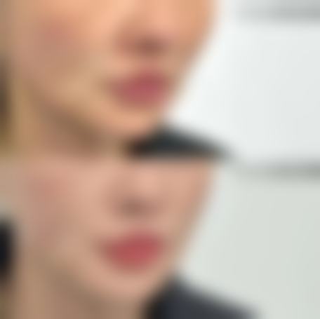 七、合肥蜀山亦生医疗美容门诊部价格表：（仅供参考）