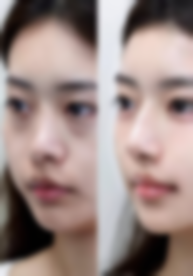 五、湖州新生植发爱美爱医疗美容诊所怎么预约：