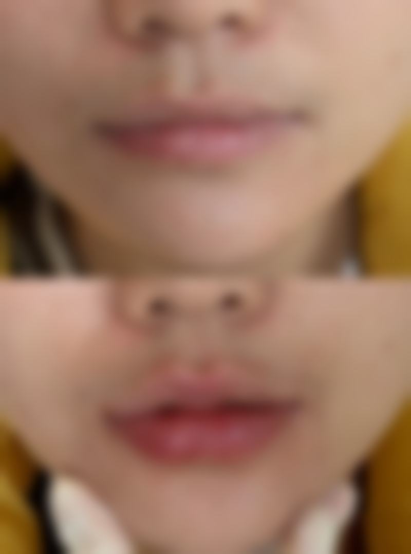 七、深圳牛翠霞整形医院真实的顾客评价如下：