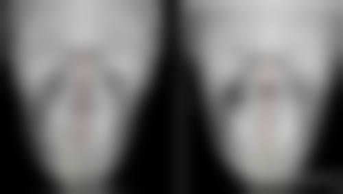 四、邵阳幻都荣恩整形医院实例