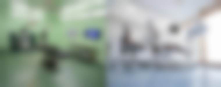 四、北京圣嘉新医疗美容医院在隆鼻失败后鼻部硅胶假体取出项目上的优势