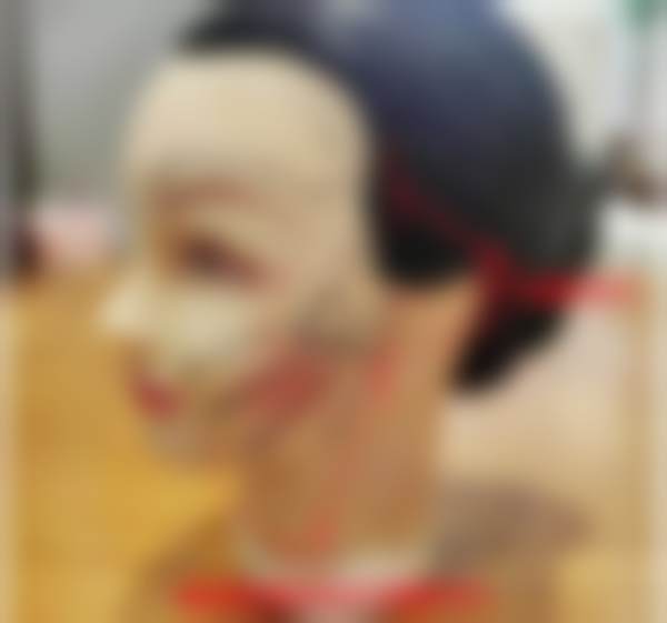 手术当天的真实感受，没我想的那么吓人