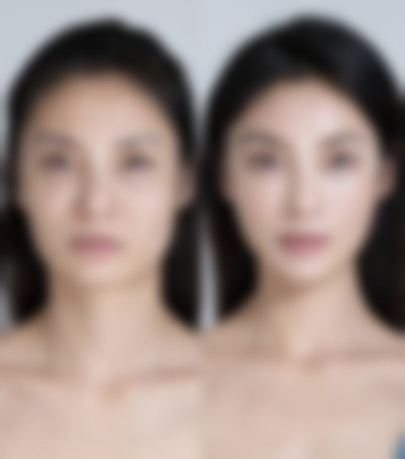 五、沈阳和平禧承整形医院怎么预约：