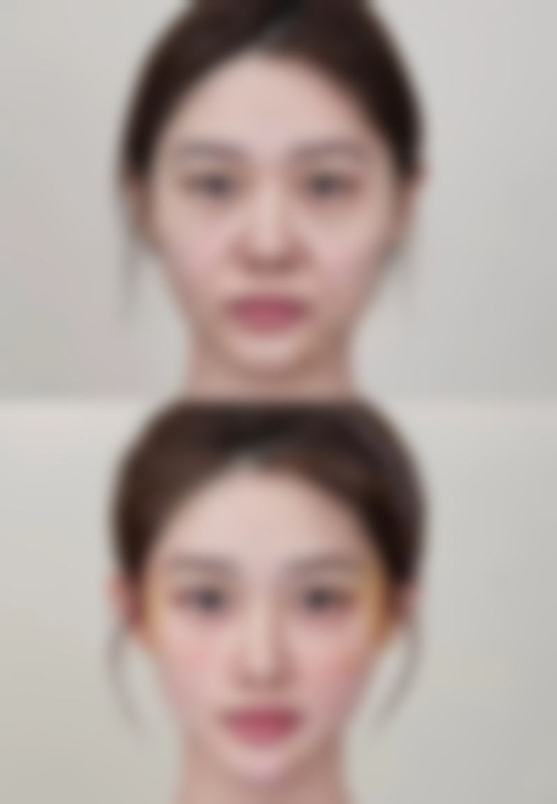 五、西安艺朵医疗美容整形医院实例