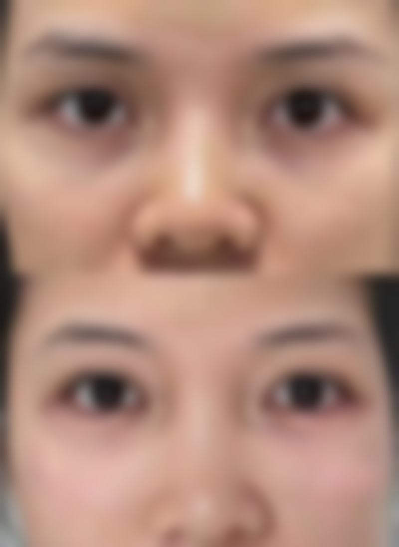 四、芜湖弋矶山医院整形美容科实例