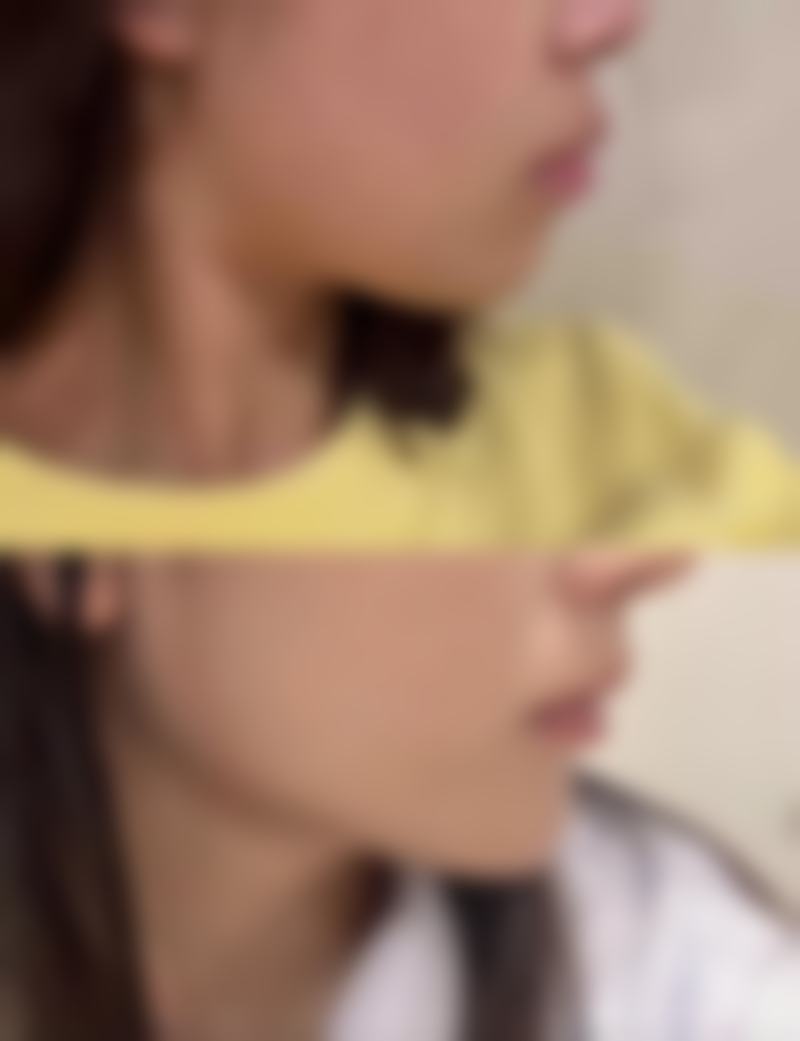 六、厦门思明柏然整形医院价格表：（仅供参考）