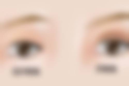 四、泉州黄惠铭医疗美容诊所实例