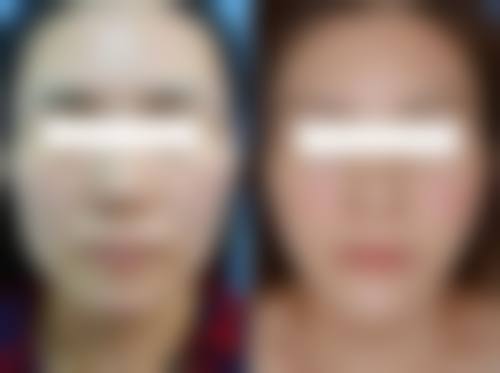 曹志明医生怎么预约？