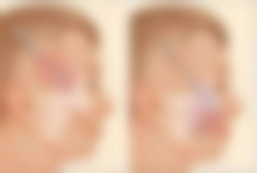 曹志明医生项目价格表参考