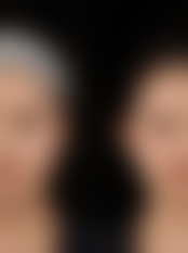 七、泉州黄惠铭医疗美容诊所真实的顾客评价如下：