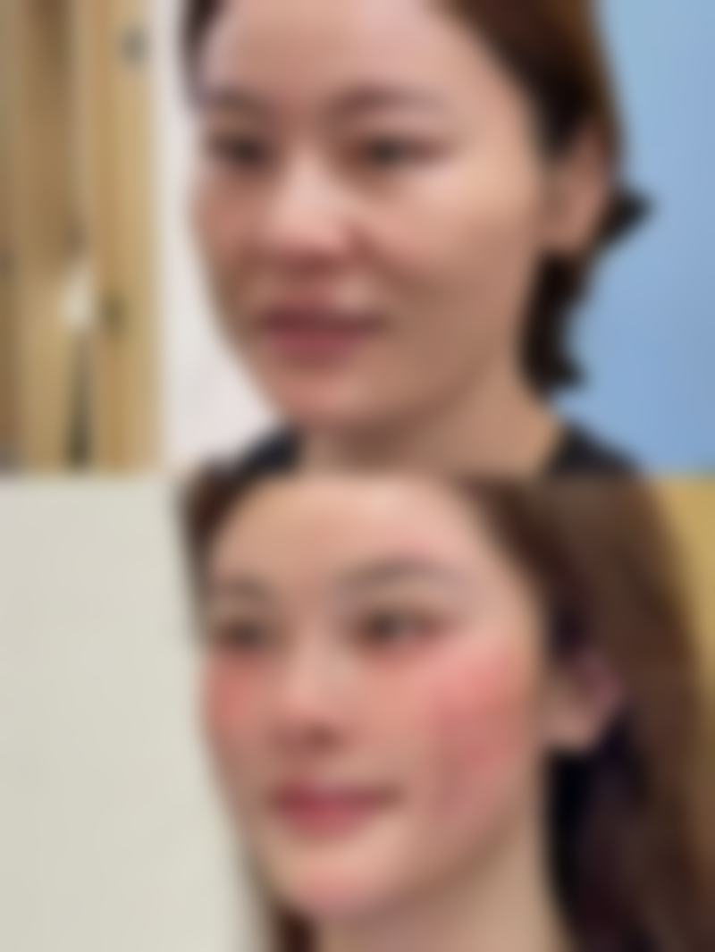 五、泉州黄惠铭医疗美容诊所怎么预约：