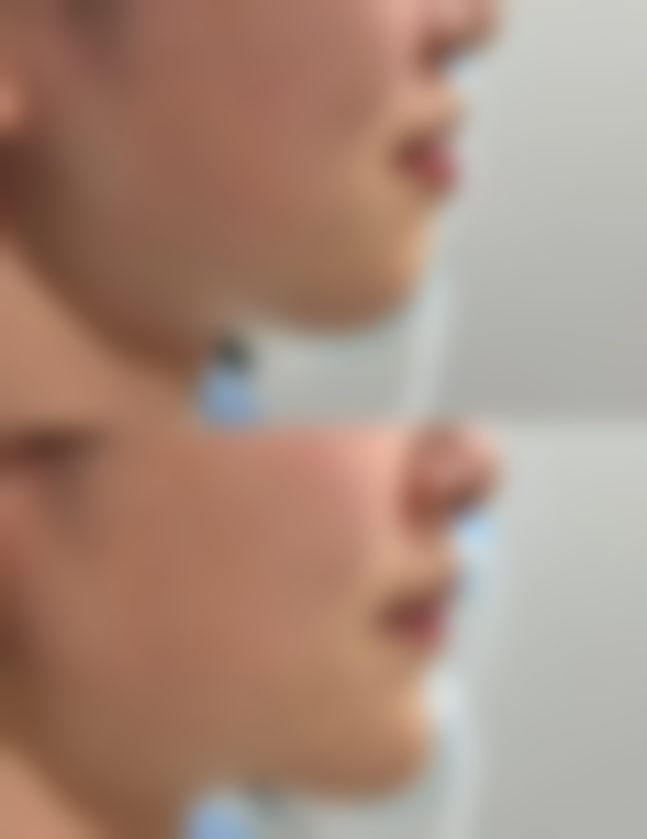 边大伟医生项目价格表参考