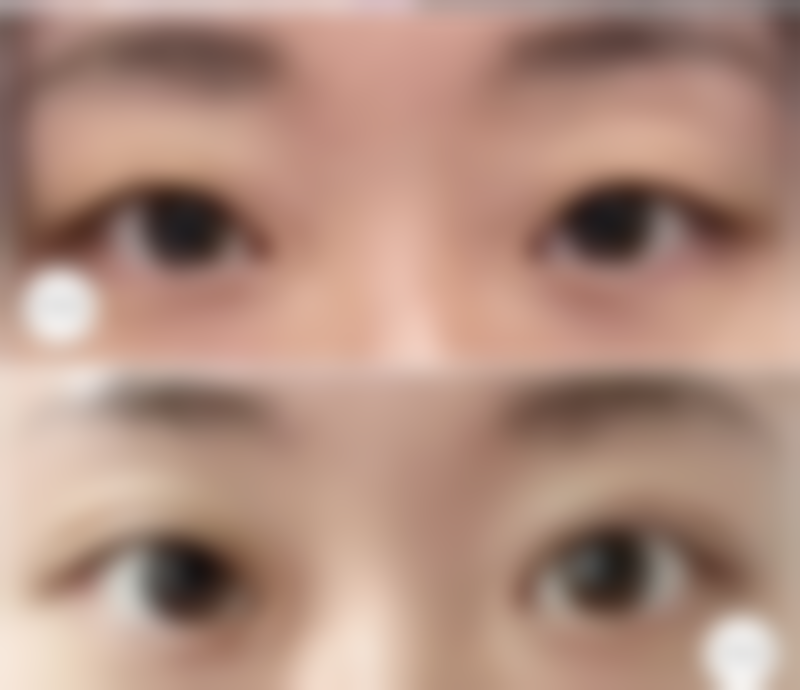 七、榆林妇产专科医院整形科真实的顾客评价如下：