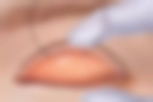 茶油真能去除眼袋吗？揭秘茶油对眼袋的调理作用及有效去眼袋方法 