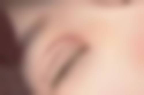 取假体隆胸风险可控吗？特殊情况也有应对之策