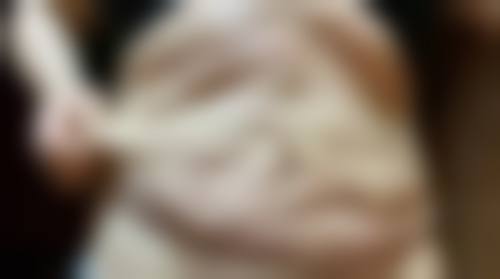 八、重庆重生毛发移植研究院真实的顾客评价如下：