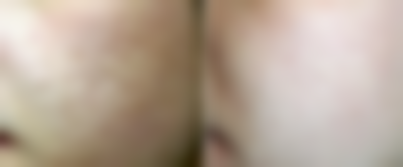 韩国林二石皮肤科医院