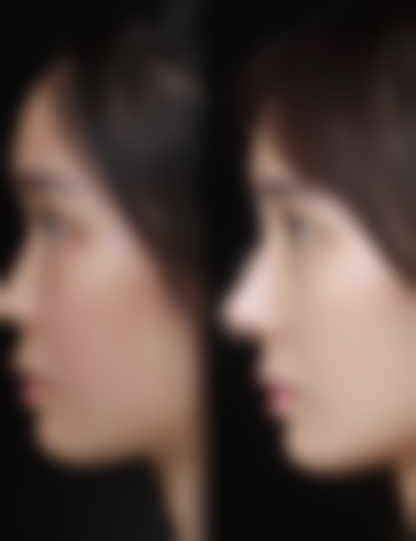 五、十堰臻玺医疗美容诊所怎么预约：