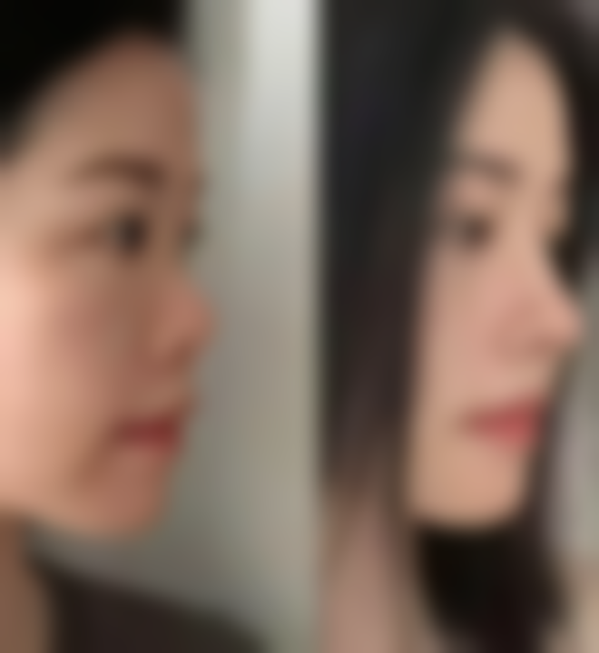 七、韩国FORHAIR毛发移植医院价格表：（仅供参考）