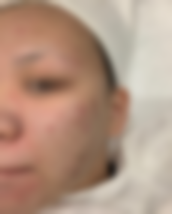 曹主事全脸操作，痛感比我预想的温和太多