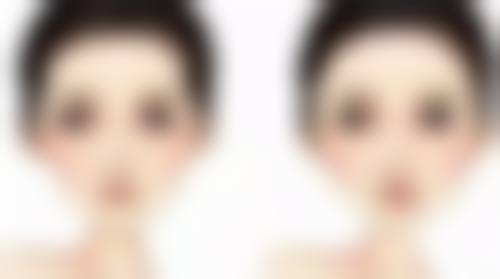 五、汕头潮南民生医院烧伤整形科实例