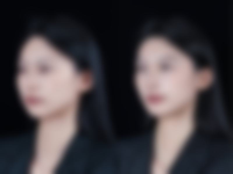 六、东莞千寻医疗美容门诊部怎么预约：