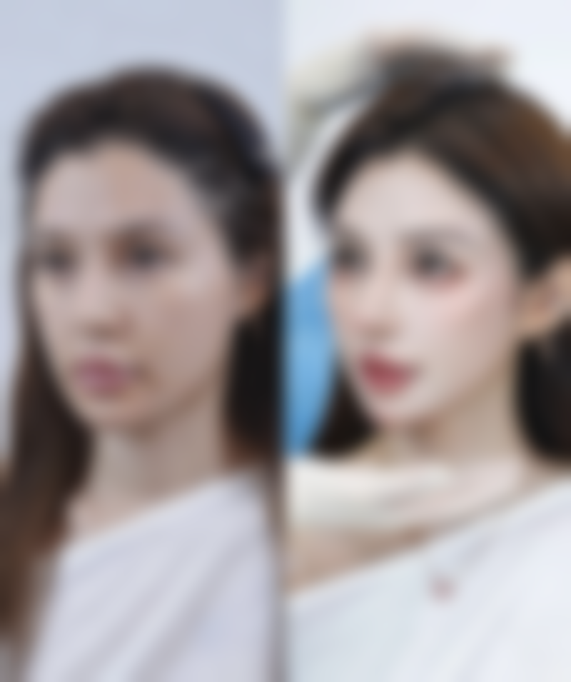 三、汕头潮南民生医院烧伤整形科医生介绍: