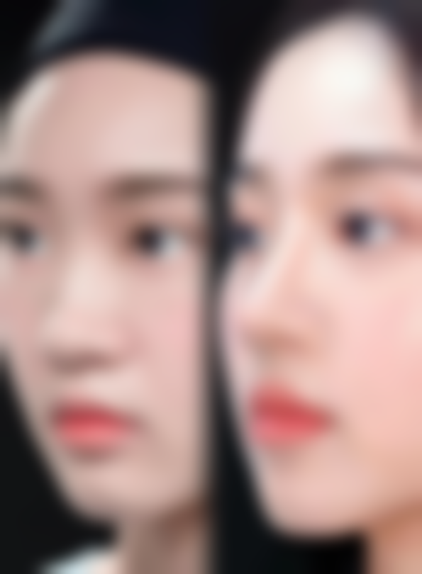 七、青海西宁润美整形医院价格表：（仅供参考）