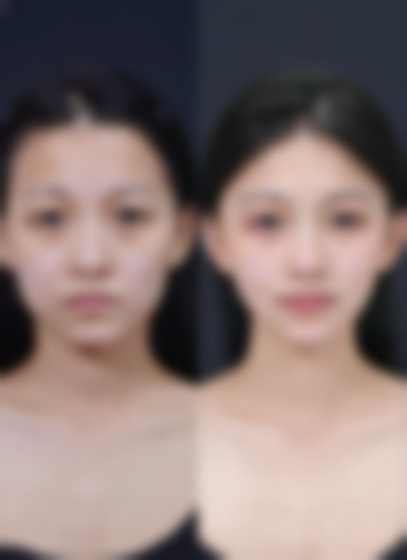 五、珠海速医美整形医院实例