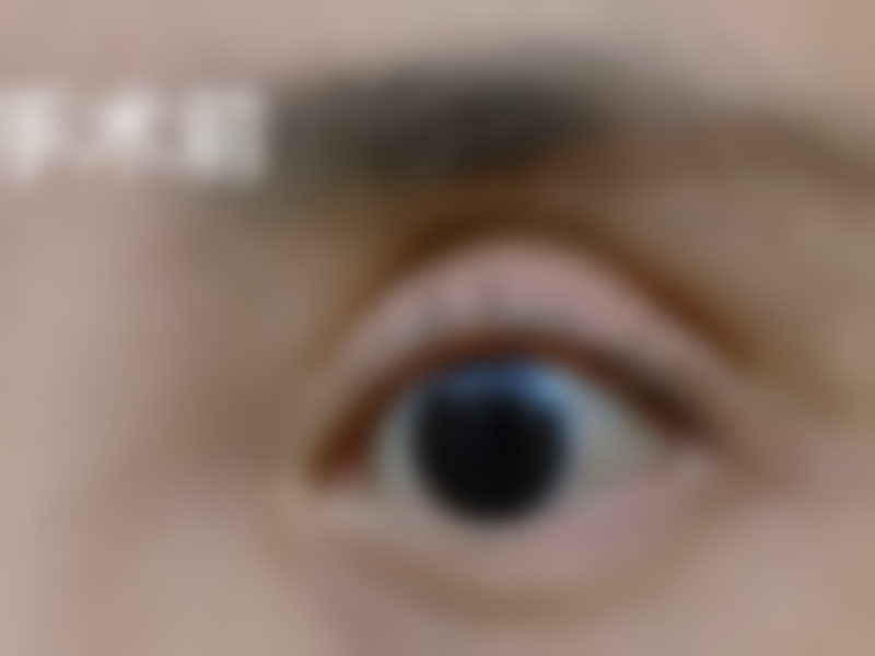 双眼皮修复失败逆袭成功！广东韩妃5000元帮求美者重拾精致眼态自信