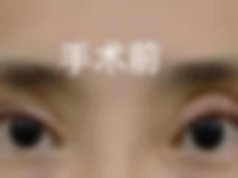 刷到韩妃的修复实例，抱着试试的心态去面诊