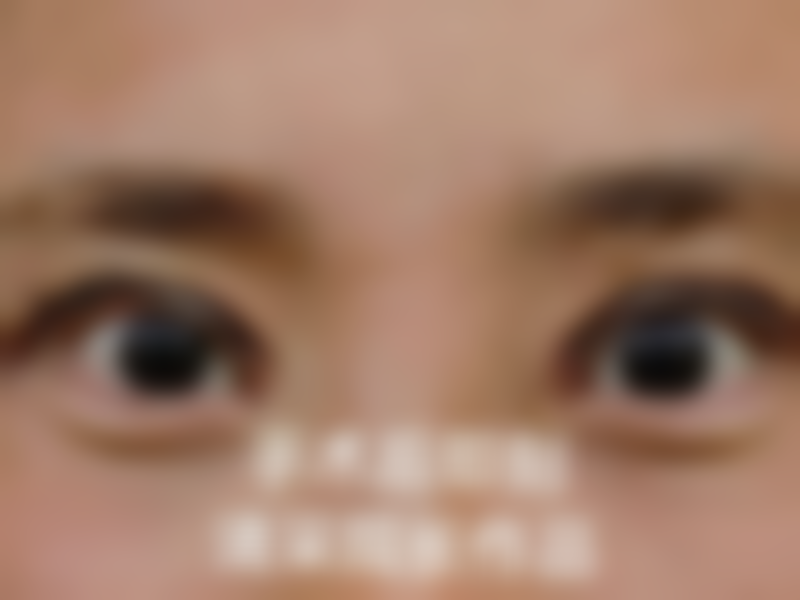 手术到修复：终于拥有了正常的眼睛