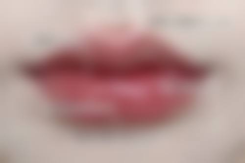 隆胸手感与真胸差异几何？植入层次决定触感