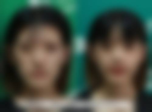 隆胸手感与真胸差异几何？个体差异不容忽视