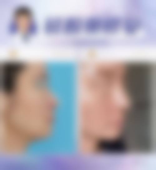 程飞医生怎么预约？