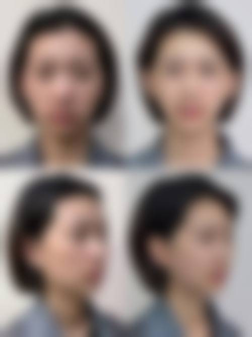 六、伊特整形外科价格表：（仅供参考）