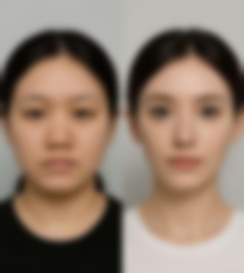 四、伊特整形外科实例