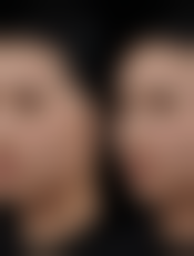 七、呼和浩特京华医疗美容诊所价格表：（仅供参考）