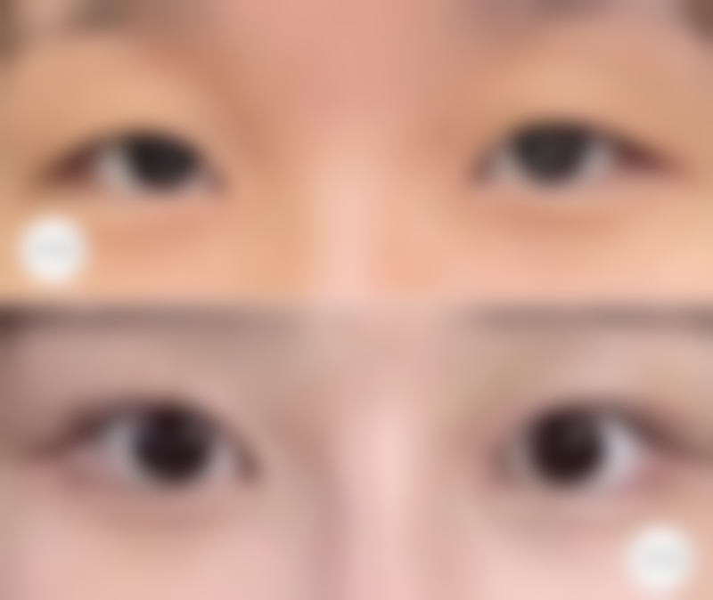 五、杭州友好医疗美容门诊怎么预约：